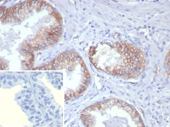 CDH1 Antibody
