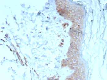 CDH1 Antibody