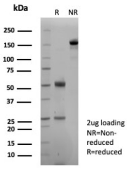 CDH1 Antibody