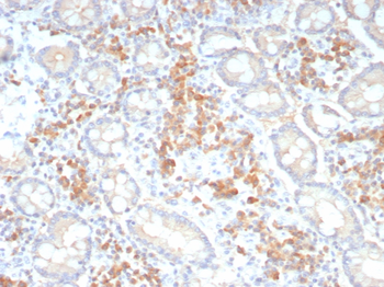 CDH1 Antibody