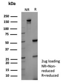 KLK4 Antibody