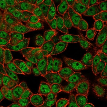 GCM2 Antibody