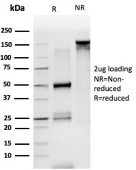 LDB2 Antibody