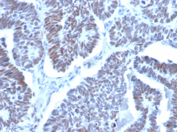 LDB2 Antibody