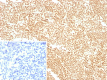 LDB2 Antibody
