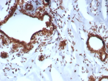 BAP1 Antibody