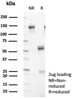YWHAE Antibody