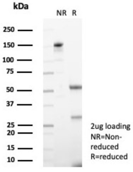 TRPC6 Antibody