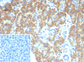 TRPC6 Antibody