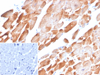 TPM1 Antibody