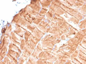 TPM1 Antibody