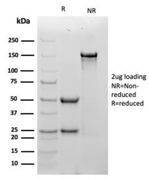 TPM1 Antibody