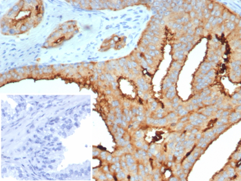 TMPRSS2 Antibody
