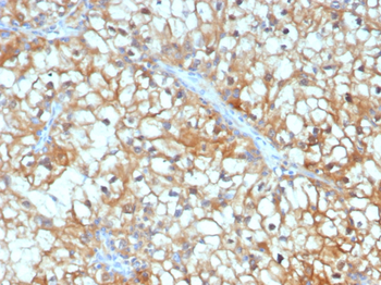 TGFB3 Antibody