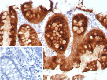 TFF1 Antibody