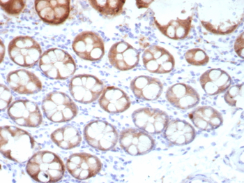 TFF1 Antibody