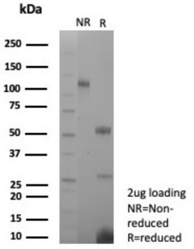 TFF1 Antibody