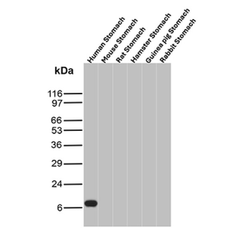 TFF1 Antibody