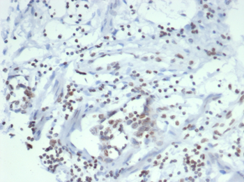 SULT1E1 Antibody