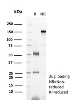 SULT1E1 Antibody