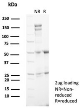 SSTR2 Antibody