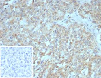 SSTR2 Antibody