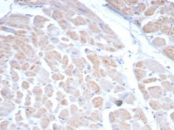 SSTR2 Antibody