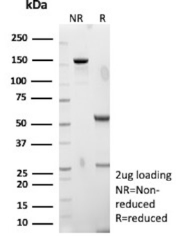 SSTR2 Antibody