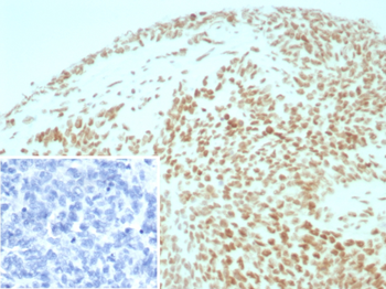 SMARCB1 Antibody