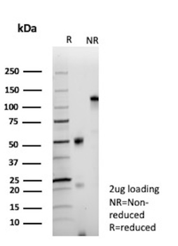 SMARCB1 Antibody