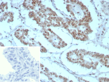 SMARCB1 Antibody