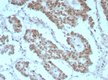 SMARCB1 Antibody