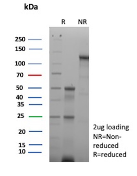 SMARCB1 Antibody
