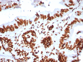 SMARCA4 Antibody