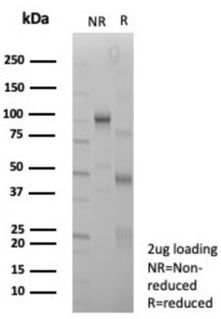 SMARCA4 Antibody