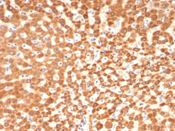 SHBG Antibody
