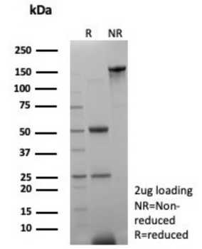 SHBG Antibody