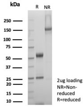 SDHA Antibody