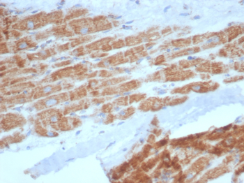 SDHA Antibody