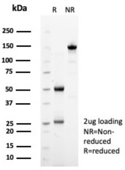 SDHA Antibody