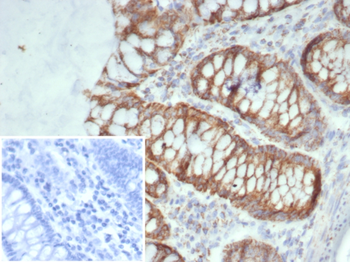 SDHA Antibody