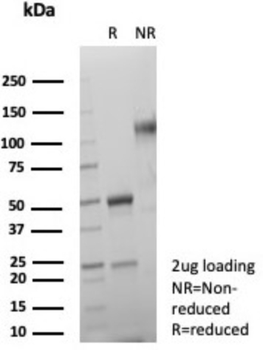 SDHA Antibody