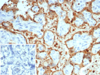 S100A12 Antibody