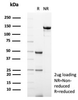 S100A12 Antibody