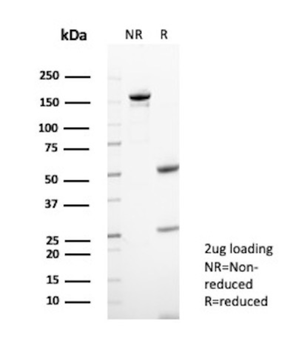 S100A11 Antibody