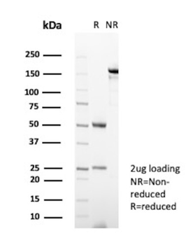 S100A11 Antibody