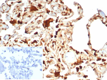 S100A11 Antibody