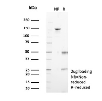 S100A11 Antibody