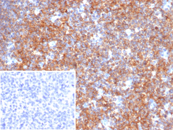 BCOR Antibody