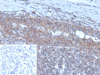 BCOR Antibody
